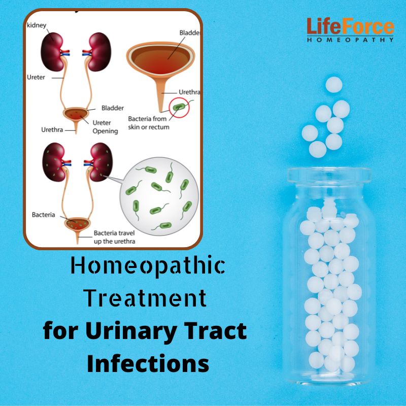 homeopathic treatment for Retention of Urine in homeopathy