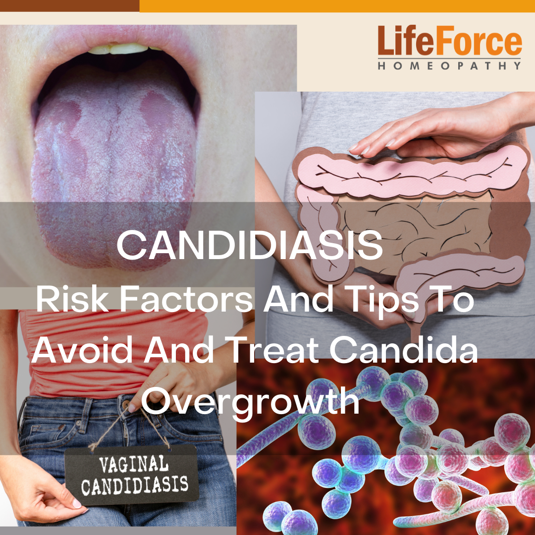 candidiasis treatment
