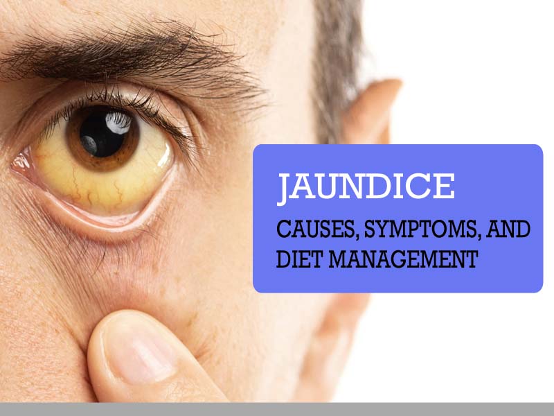 causes of jaundice eyes